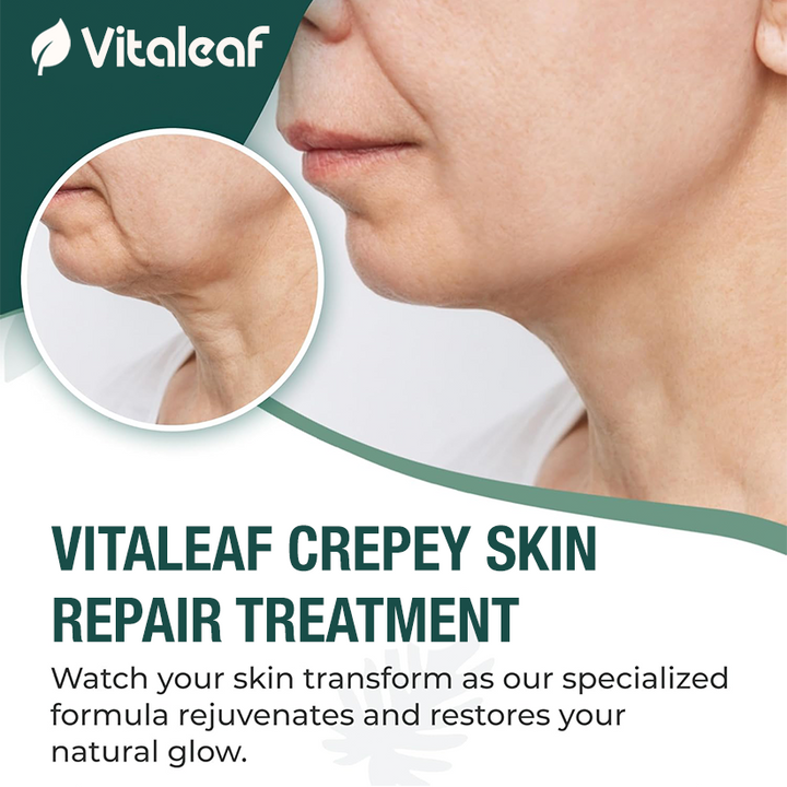 Crepey Skin Repair Treatment